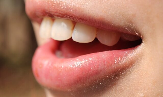 Probiotic For Healthy Teeth and Gums